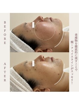 クラームビューティー(Clerm beauty)/リアボーテタラソトリートメント