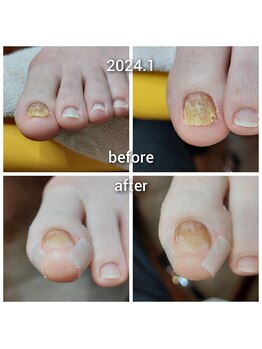 爪切り屋 足楽/爪の整え