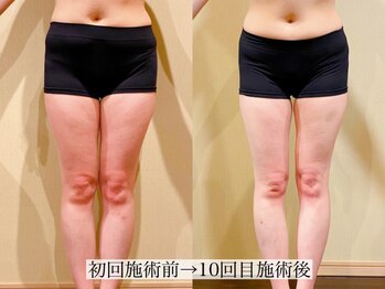 アンジー(Angie)/スラリ美脚に大変身