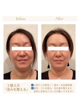 ソワン(soin)/小顔矯正・整顔×エステ