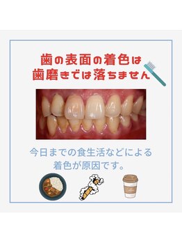 ホワイトニングショップ 新小岩店/歯科提携 ホワイトニング専門店