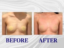 ザモア 福岡天神(THE MORE)/【症例 Before After】