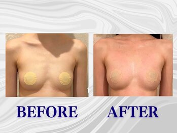 ザモア 福岡天神(THE MORE)/【症例 Before After】