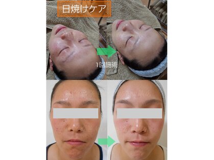 肌質改善サロン 姫路駅前店の写真