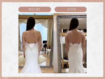 ソウイボディ 武蔵小杉店(Sou-i body)/ブライダルbefore→ after