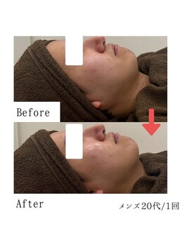 グラシア(gracia)/シミ・毛穴ケア専門店gracia