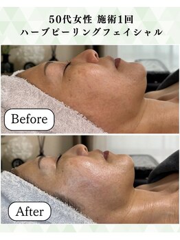 シーフェイス 横浜店(SEE FACE)/肌のハリツヤ透明感トーンアップ