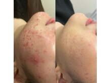 他多数フォトギャラリーにビフォー・アフターございます！