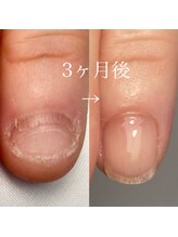 カラー(calla)/変化は歴然