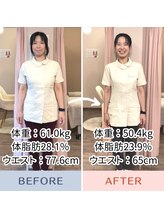 セントラル治療院はりきゅう大心/耳つぼダイエットの結果！