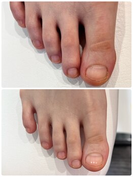 フットファースト 小田原大井町店/爪ケア　爪艶仕上げ付き