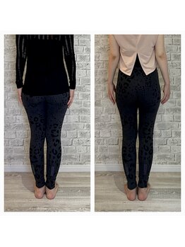 クオン(kuon)/お客様ビフォーアフター