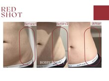 シャンディール(shandeel)/