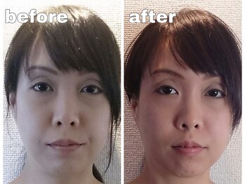 噂のほぐし屋 コリトル整体院/1回の小顔+整体施術で効果あり!