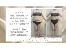 リブ 三軒茶屋(LiB)の雰囲気（眼精疲労、首肩こり、深層リンパ、姿勢骨盤歪み、美痩身本格ケア）