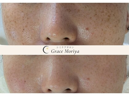 グレイス モリヤ(Grace Moriya)の写真