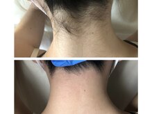 マイレ 銀座(MAILE)/うなじ