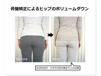サロンブルー(Salon Blue.)/骨盤矯正ビフォー・アフター