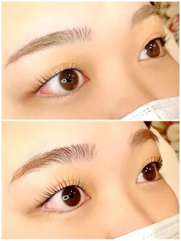 オメメ 八王子(omeme)/ラッシュアディクト使用前・後