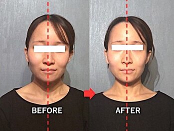 アトラス/初回のお客様のBefore＆after