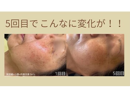 ベル(Belle)の写真