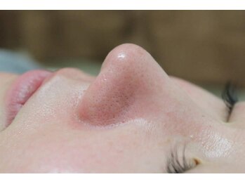 プリエ(PRIER)/毛穴引き締め/毛穴ケア/エステ