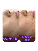 リンパクリニークアリス/シミケア