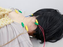 ＜鍼＞深部のコリにしっかり効果◎美容鍼も!