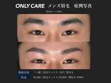 オンリィケア 関大前(ONLY CARE)/【メンズ眉毛】