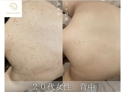 スキニティ 池袋(sknity)の写真