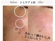 サロンドボーテ ベル(SALONDEBEAUTE BELLE)