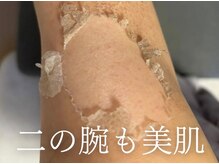 ブルーム(bloom.)の雰囲気（お顔・背中・お尻、それから二の腕も！！）