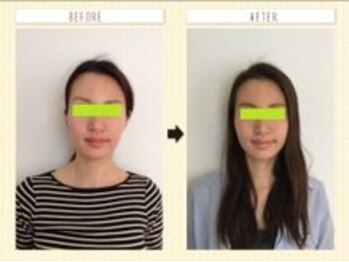 美容整体ウェリナ あま甚目寺院/小顔矯正/骨盤矯正/美脚サロン