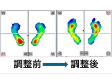 富崎カイロプラクティックオフィスの雰囲気（調整前と調整後の重心を測定し、バランスの変化を確認できます。）