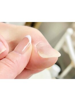 爪の悩みを解消できる（ケア含む）