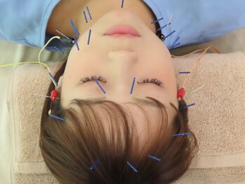 たんぽぽ鍼灸整体院の写真/既にファン多数☆肩こりや腰痛にもアプローチできる"美容鍼灸"はたんぽぽ！確かな技術で健康的に美しく♪