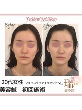 瑞 鍼灸院/ビフォーアフター