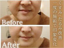 サロンドエステ ルヴニール(salon de esthe revenir)