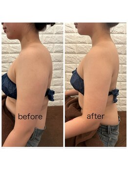 リジュ 小倉(Reju)/二の腕スッキリ