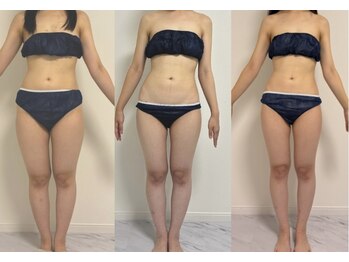 プリマルーチェ/【お腹・下半身】