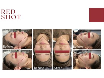 シャンディール(shandeel)/