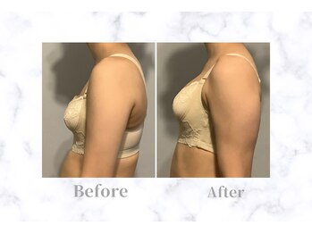 ふじこのきもち/18回コース終了　20代