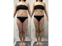 ナルシス/【痩身】約10ヶ月の変化★