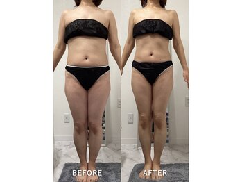 ナルシス/【痩身】約10ヶ月の変化★