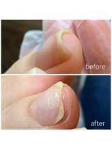 リネイル 長浜(Re-na-iL)/ネイルケア＆スパ¥7000