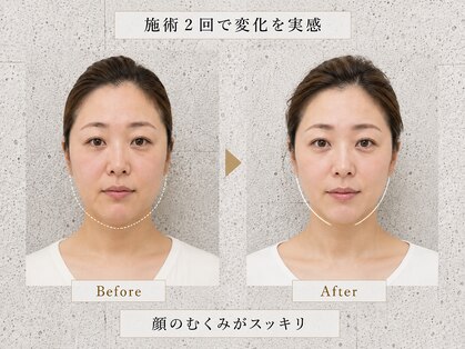 キシビューティーサロン(KISHI BEAUTY SALON)の写真