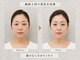 キシビューティーサロン(KISHI BEAUTY SALON)の写真