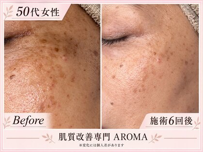 アロマ(AROMA)の写真
