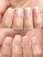マリーロール 梅田店(Marie Laure)/深爪矯正/自爪育成/自爪風