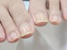 【FOOT】　巻き爪ケア　(ジェル）　　1本　　